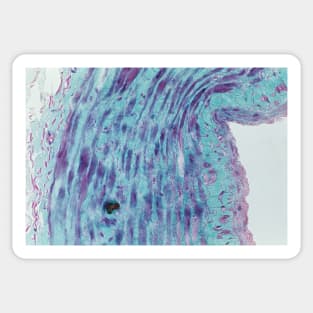 Saphenous vein, light micrograph (C023/7530) Sticker